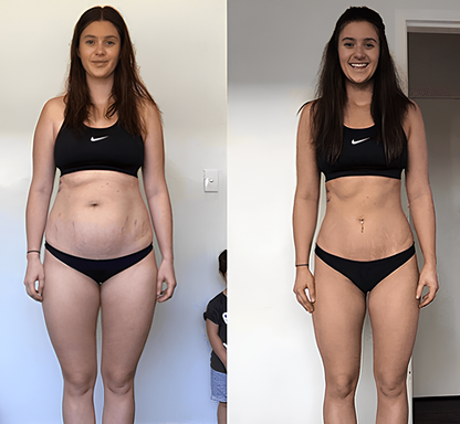 [COMPRA 1 Y LLEVA 2] BALLOON SLIM LONGEVIX