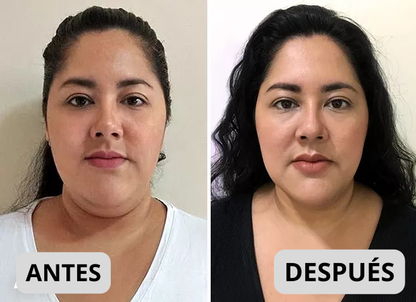 Súper Mascara Reductor De Papada